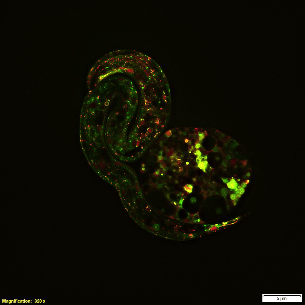 Live Cell Imaging With Super Resolution Biotechniques