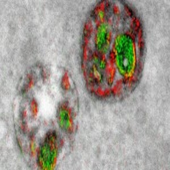 Multicolor Labels in Electron Microscopy [Roger Tsien] - BioTechniques