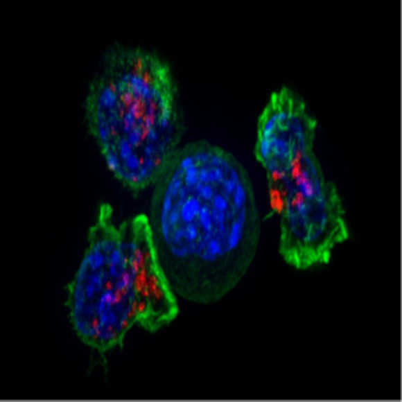 Novel Human T Cells Might Have Cancer Fighting Potential   Novel Human T Cells Might Have Cancer Fighting Potential Fi 