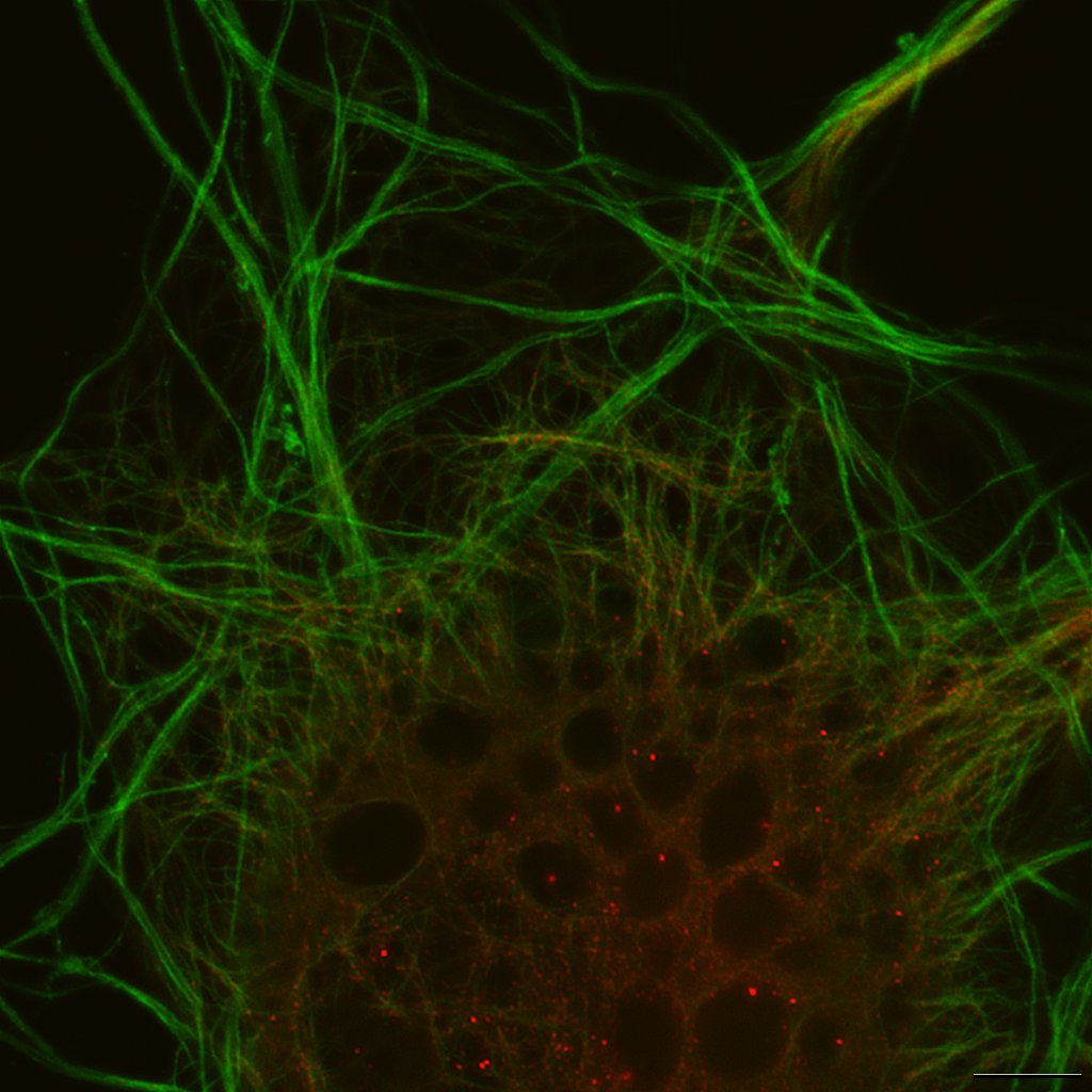 Live Cell Imaging With Super-Resolution - BioTechniques