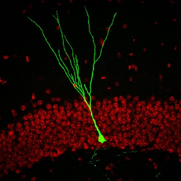 Brain Repair By Transforming Glial Cells Discovered - BioTechniques