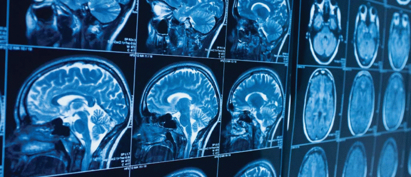 Neurocriminology brain mri scan image